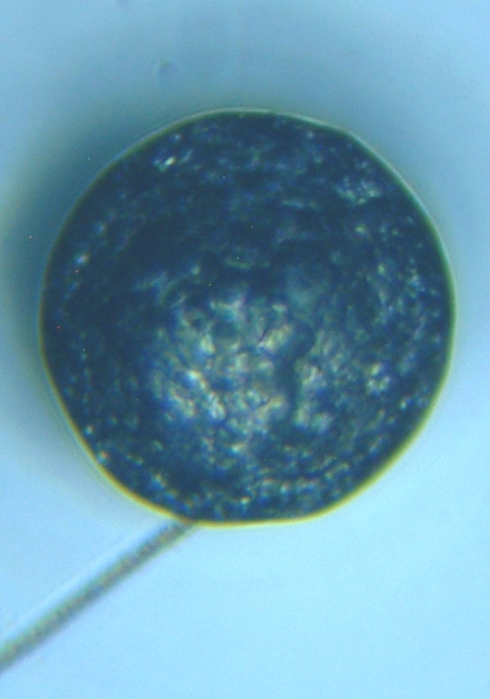fig.02 ṽmÊQiޏ̗j
Leptodora kindtii (her egg)