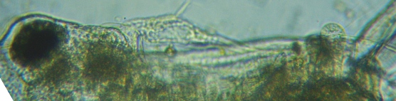 fig.03 ṽIiK~WRiIXj
Diaphanosoma (male )