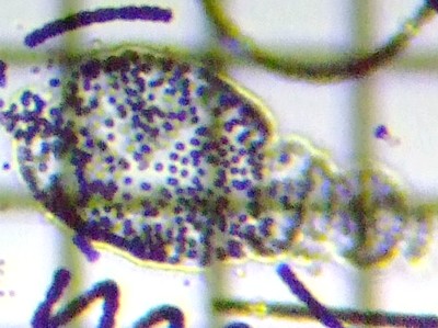fig.03 ~NLXeBXx[[xM[ Microcystis Wesenbergii