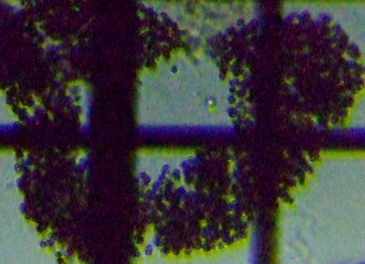 fig.02 ~NLXeBXGMm[U Microcystis Aeruginosa