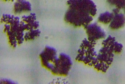 fig.04 ~NLXeBXrfBX Microcystis Aeruginosa